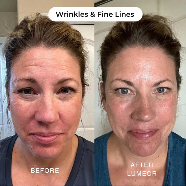 Restore® The Collagen mask Sleep Seal
