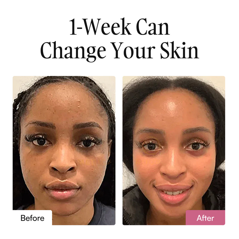 Restore® The Collagen mask Sleep Seal